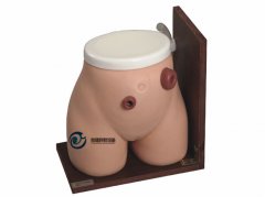 高級瘺管造口術(shù)護(hù)理模型